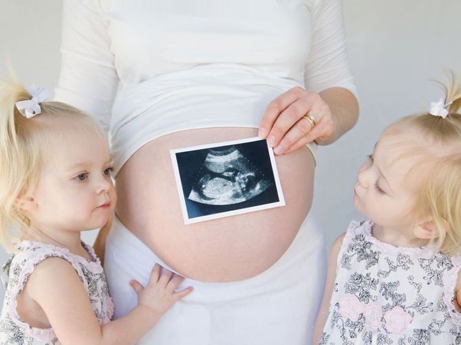 Cara Meningkatkan Peluang Hamil Anak Kembar